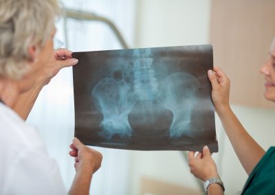 artroplastia-quadril-2